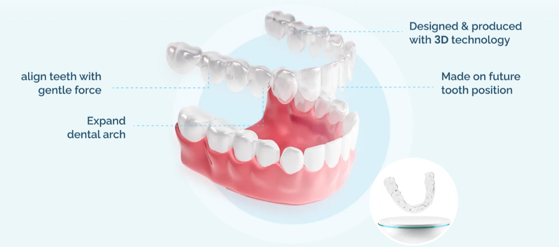 Clear Aligner Process